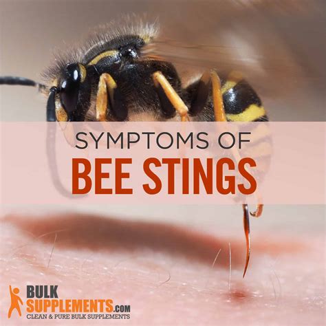Bumblebee Insect Sting