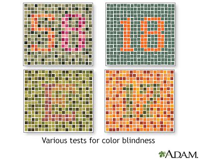 Eye Color Vision Test 的图像结果
