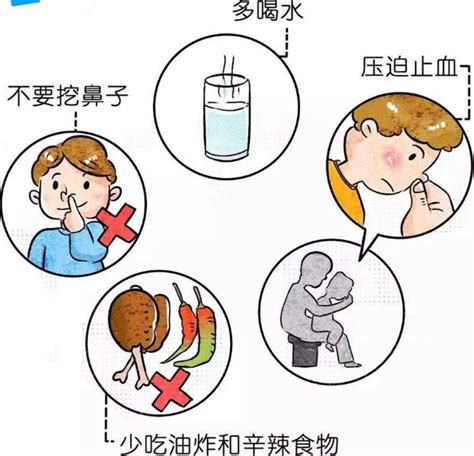 【北大培文幼儿园】小儿鼻出血的预防及急救措施