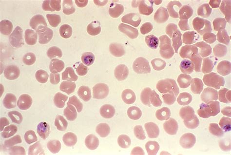 Free picture: monkey, blood smear, falciparum, parasites, 24hrs ...