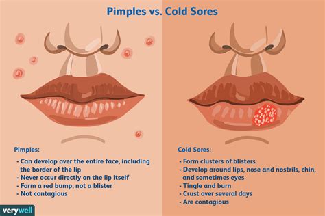 Image result for Pimple From Dry Lips