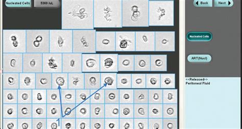 Body Fluids Analysis 的图像结果