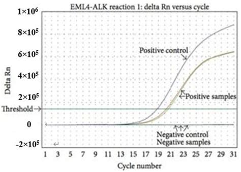 Therapeutic Advances of Rare ALK Fusions in Non-Small Cell Lung Cancer