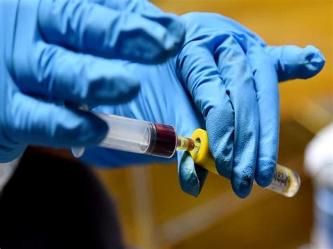 Hyderabad hospital becomes first in India to use AI tool for blood ...