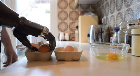 Image result for Bebionic Hand Users