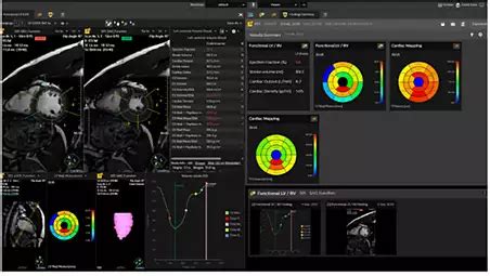 Advanced Visualization Workspace 15 | Philips