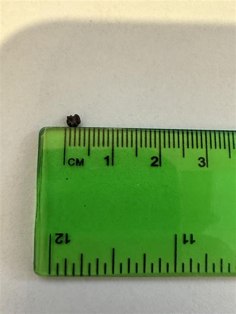 Bladder Spasms 的图像结果