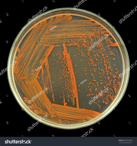 Orange Bacterial Colonies On A Petri Dish (Agar Plate) Isolated On A ...