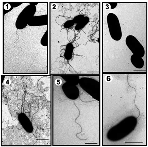Polar Glycosylated and Lateral Non-Glycosylated Flagella from Aeromonas ...