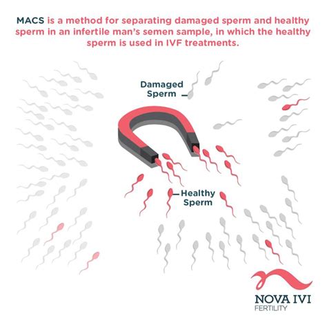 Image result for Magnetically Activated Cell Sorting