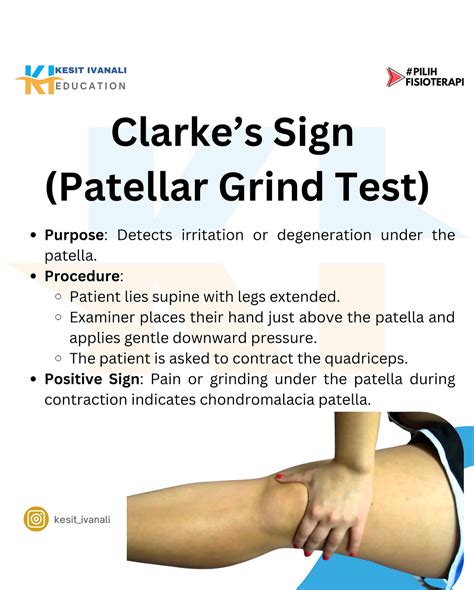 Patellar Grind Test