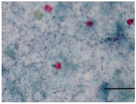 Cryptosporidium Infections in Neonatal Calves on a Dairy Farm