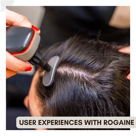Nioxin vs. Rogaine: Which Hair Loss Treatment is Right for You ...