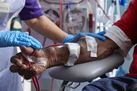 Haemodialysis access with an arteriovenous fistula | Kidney Care UK