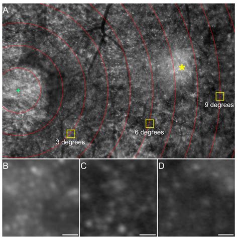 Validated Filter-Based Photoreceptor Count Algorithm on Retinal ...