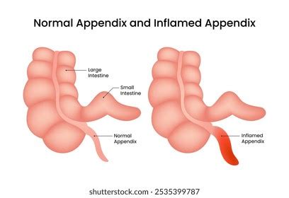 Image result for Appendix Example Website