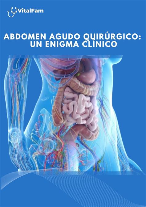 Amazon | Abdomen Agudo Quirúrgico: Un enigma Clínico (Spanish Edition ...