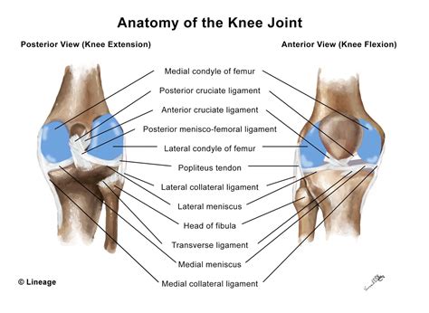 Anterior Cruciate Ligament Tear