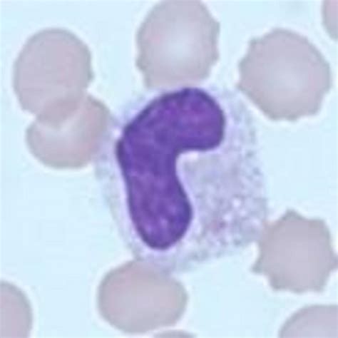 Neutrophil Band Cell