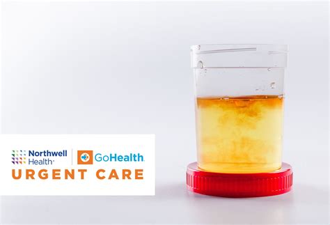 Foul Smelling Urine: A Potential Health Risk? | The Well by Northwell