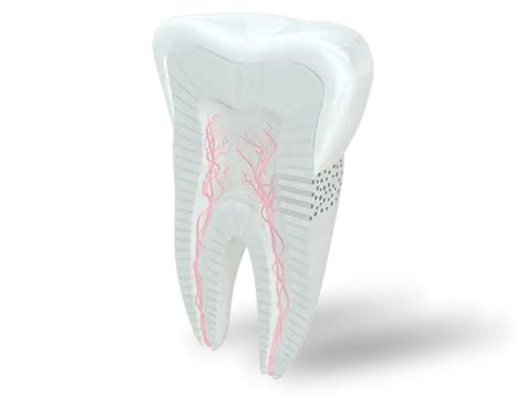 Do I have a cavity or sensitive teeth? | Sensodyne