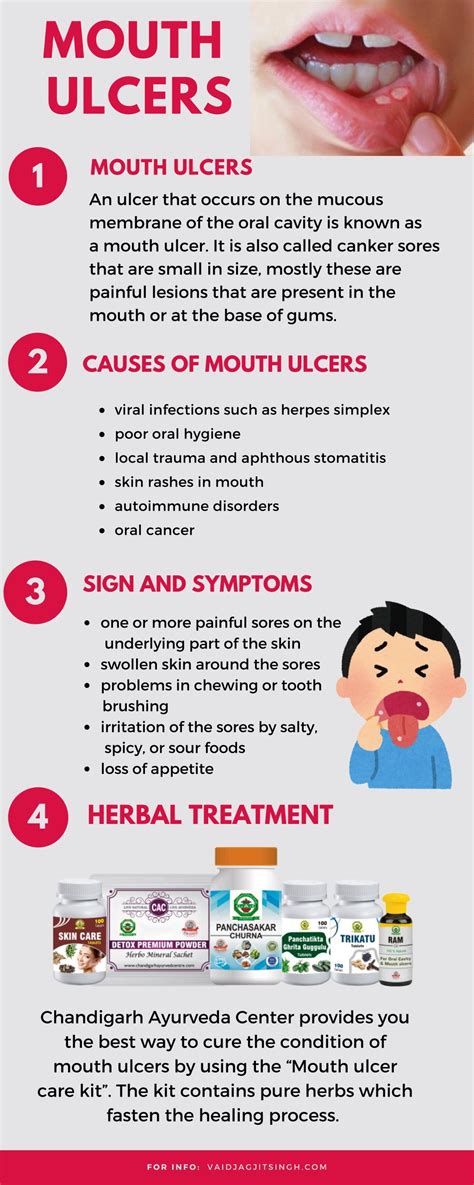 PPT - Mouth Ulcers - Causes, Symptoms and Herbal Treatment PowerPoint ...