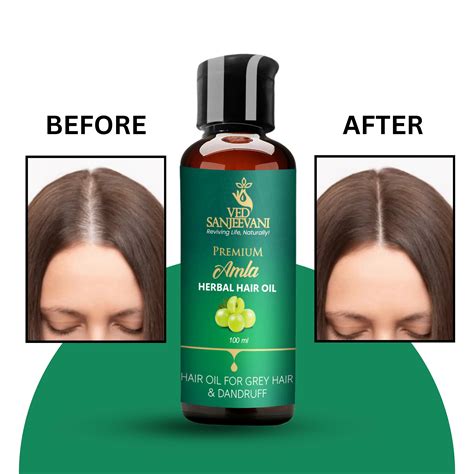 Amla Herbal Hair Oil – Ayurvedic hair oil for strong roots, hair growth ...