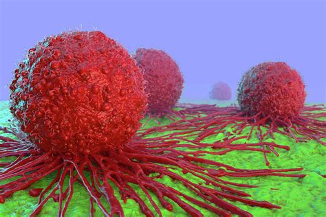 Image result for Cancer Detection Using Graph CNN