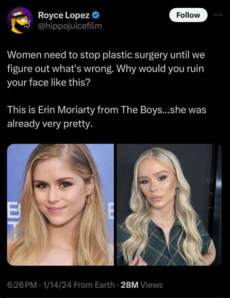 Erin Moriarty Plastic Surgery: Image Gallery | Know Your Meme