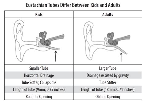 Adult Tubes Ears