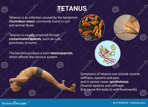 Tetanus Bacteria Diagram