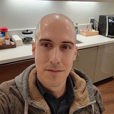Maturing hairline Vs balding : r/bald