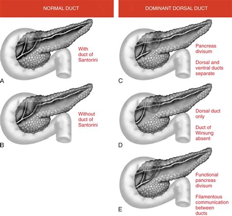 Pancreatic Problems in Infants and Children - Clinical Tree