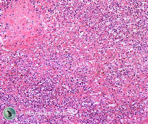 Image result for Tissue Sample Test