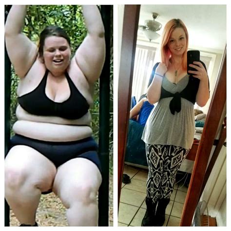 Photos: Woman loses 193 pounds, shares 'ugly' 'reality of extreme ...
