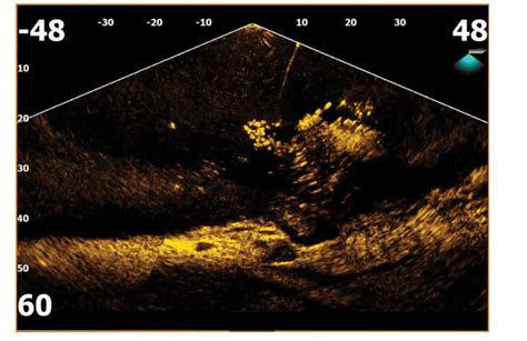 Image result for Using Active Target for Fishing