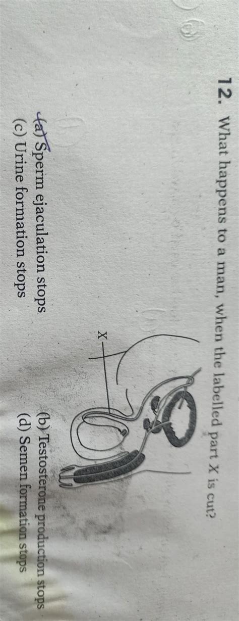what happens to a man when the labelled part x is cut - Brainly.in