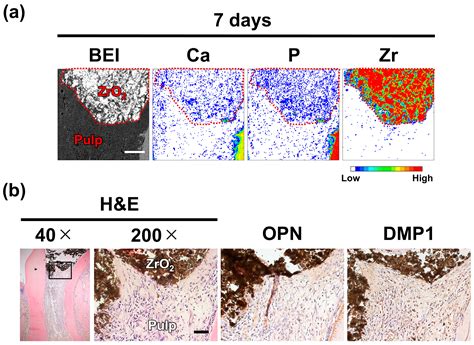 Role of Dystrophic Calcification in Reparative Dentinogenesis After Rat ...