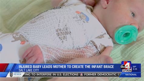 Clavicle Fracture Newborn