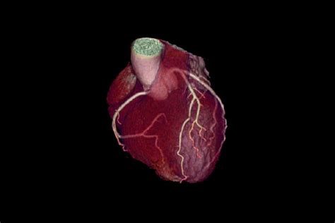 Effortless Workflow for Compted Tomography | GE HealthCare (India)