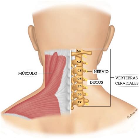 ¿Dolor en el cuello a nivel cervical? | Reumatología Perú