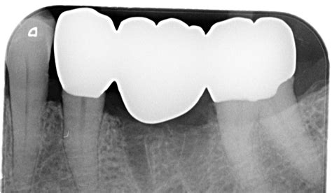 Clinical case by Dr. Florian Zwiener