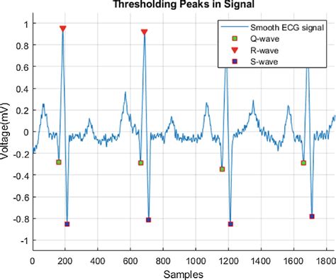 Image result for Waveform Error Detector Using CNN