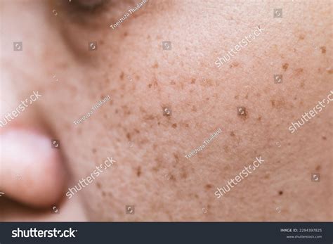 Image result for Melisma Examples