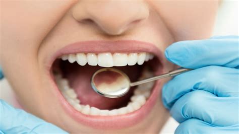 suffering from loss teeth follow these home remedies | आप भी दातों के ...