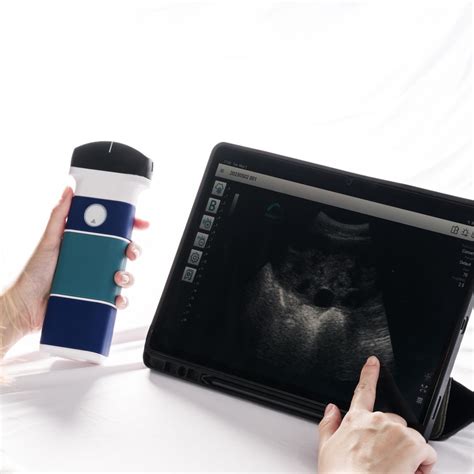 Best Wireless Handheld Ultrasound at Herman Dunlap blog
