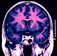 Image result for Computer Assisted Surgery