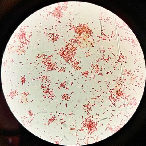 Escherichia coli Gram-stain | E. coli bacteria, Gram-stain n… | Flickr
