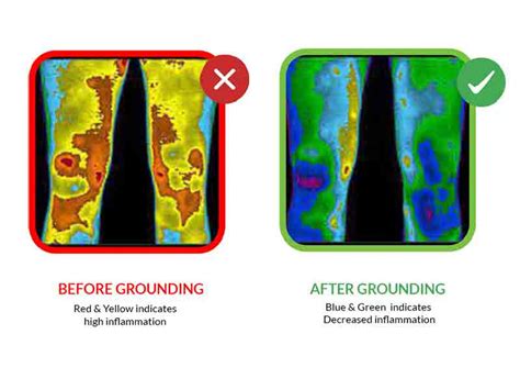 sleep12 – Grounding Mat