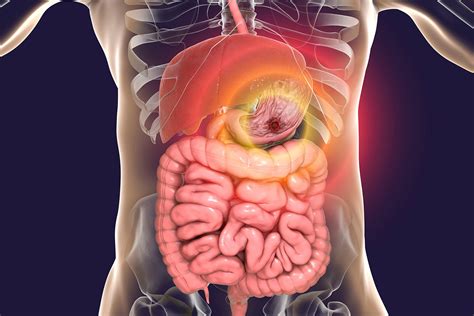 Most Trusted Nutraceuticals Third Party Manufacturer in India - Boxent ...